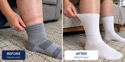 Illustrative before and after for larger legs: regular sock vs SOKLA Original